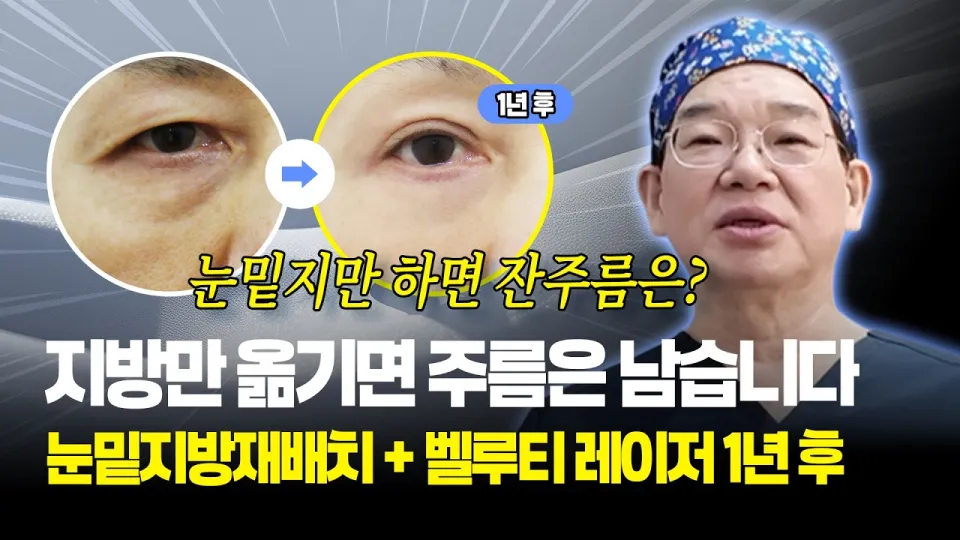 눈밑지방재배치, 볼록한 지방·늘어진 피부·잔주름을 층별로 푸는 법